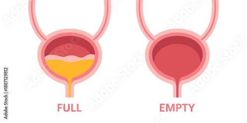 Illustration of bladder full and empty for health awareness