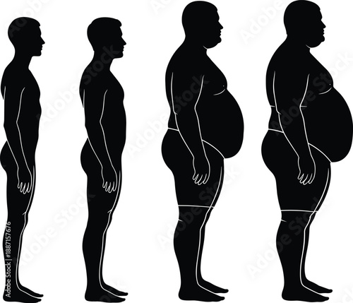 Evolution of Male Body Types Progressing from Lean and Fit to Overweight and Obese Silhouettes Representing Health Changes Weight Gain and Metabolic Syndrome Issues