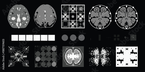Medical imaging scans displaying axial brain views and related data visualizations