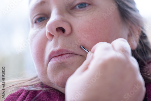 Fotografi mature female lips, removes with metal tweezers excess facial hair, excessive ha