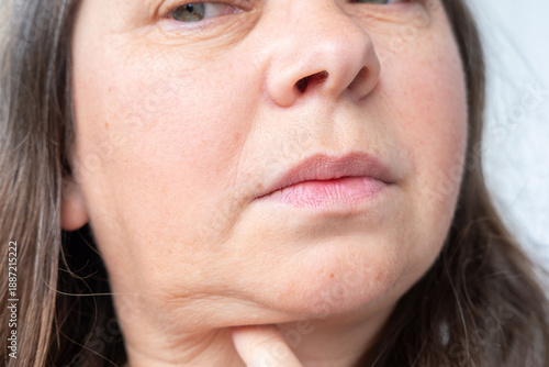 Foto part face mature woman 50 years old, human fat neck, female double chin removal,