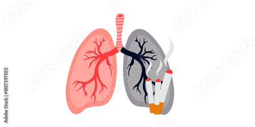 Healthy vs Smoker's Lung