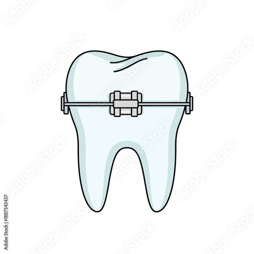 Tooth brace for dental correction and alignment of teeth
