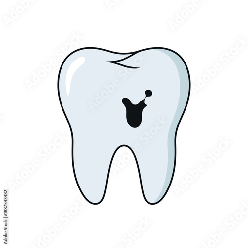 Illustration of a human molar tooth with a cavity, representing dental decay and toothache problems