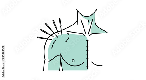 Acupuncture needles in shoulder and neck of a person, vector illustration