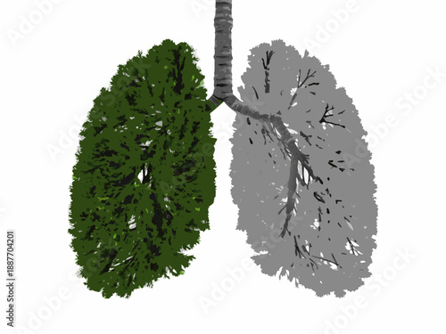 A conceptual illustration of lungs shaped like trees one healthy one damaged