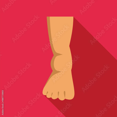 Swollen ankle on a bare leg indicating injury and pain, flat design concept