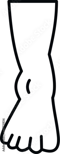 Line drawing of a human leg with edema in the ankle area, representing an injury