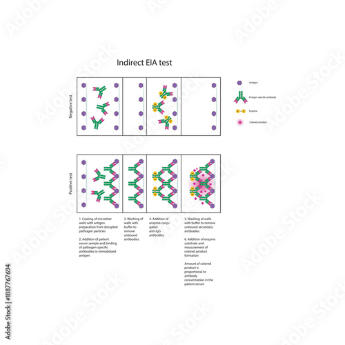 Indirect EIA (ELISA) test diagram illustrating antibody detection, enzyme-linked secondary antibodies, colorimetric signal, and quantitative immune response diagram