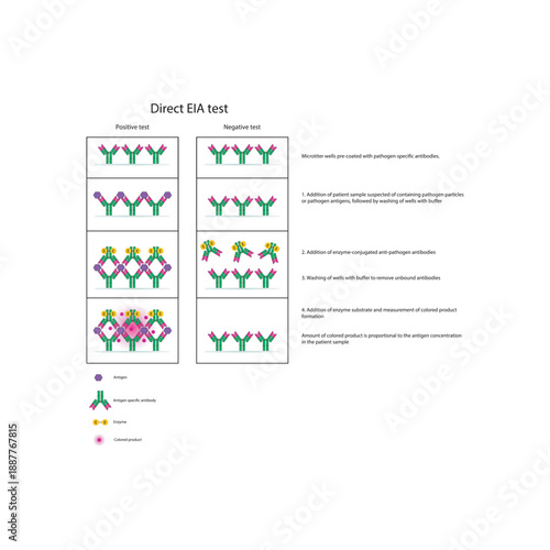 Direct EIA (ELISA) test diagram illustrating antigen detection using enzyme-labeled antibodies, colorimetric signal generation, and quantitative diagnostic results