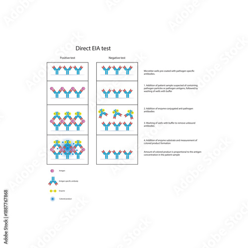 Direct EIA (ELISA) test diagram illustrating antigen detection using enzyme-labeled antibodies, colorimetric signal generation, and quantitative diagnostic results