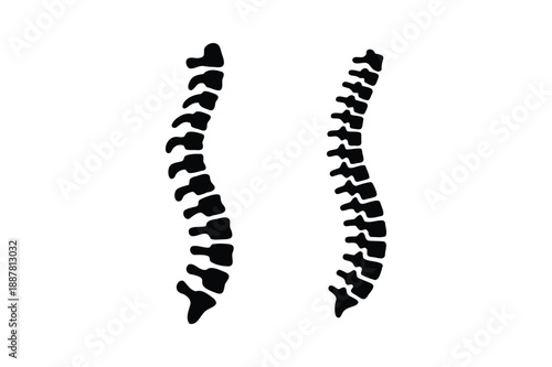 Black and white of two curved spinal columns with vertebrae