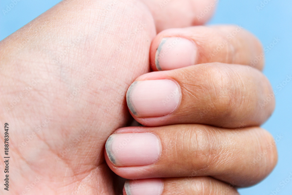 Fototapeta premium Close up of dirt that accumulates under fingernails. Hand care. Personal hygiene