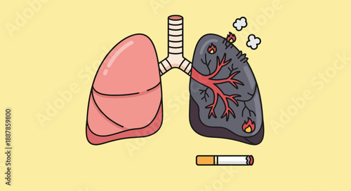 Healthy versus unhealthy lungs one pink and one black with smoke and fire next to a cigarette.