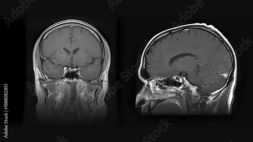 Neuroimaging Data in MRI Brain Slices. MRI scanning with spatial layer analysis in brain research demonstrates the technology's high effectiveness in detecting abnormalities associated with cognitive 