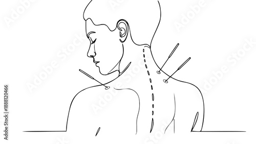 Acupuncture Therapy Traditional Medicine Back Line Art Minimal Wellness Concept