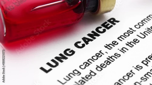 Close up of a health information document about lung cancer
