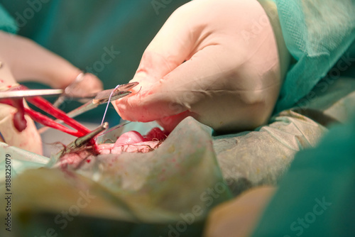 Surgeons Perform Precision Operation With Sterile Tools In The Operating Room