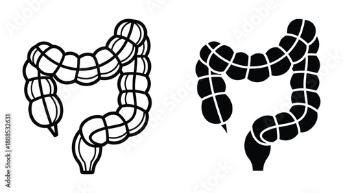 Illustration of human colon anatomy