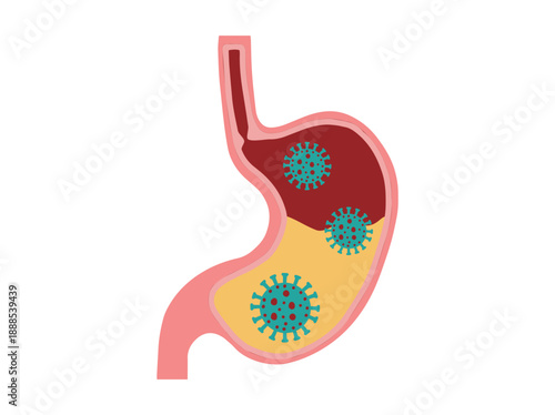 Stomach Infection Bacteria Virus