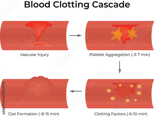 Blood Clotting Cascade Stages of Hemostasis