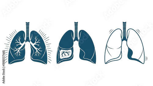 Conceptual illustrations depicting diverse human lung conditions from healthy function to various medical issues and respiratory distress