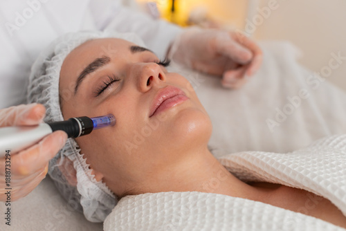 Cuadro en lienzo Peeling, woman health care, skin regeneration, dermapen microneedling, dermastamp