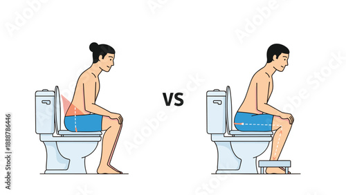 Comparison between incorrect sitting posture and the proper ergonomic way to sit on a toilet using a small footstool for health.