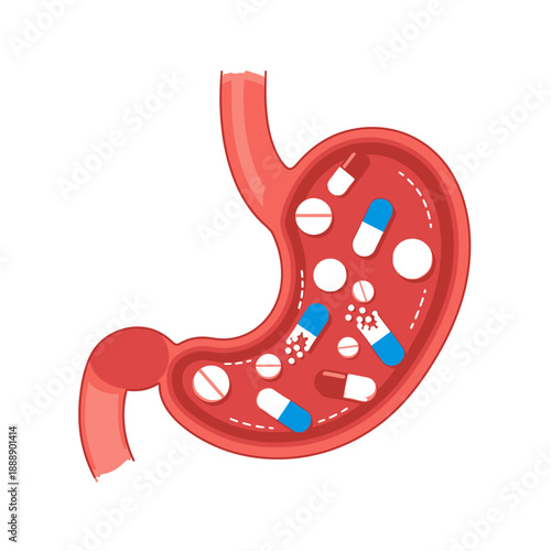 Stomach full of pills and capsules, medical illustration