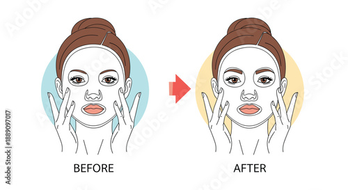 Beauty illustration showing the before and after effects of a woman using a facial sheet mask for skin hydration and skincare routine.