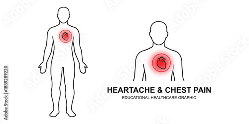 Heartache and Chest Pain Medical Illustration Human Body Infographic.