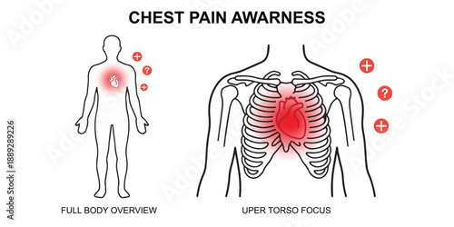 Heartache and Chest Pain Medical Illustration Human Body Infographic.