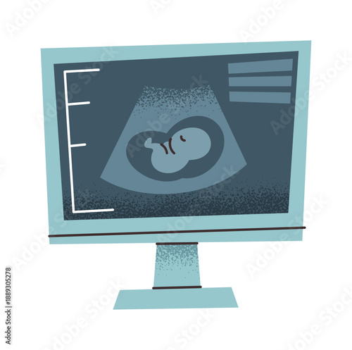 Baby in womb ultrasound screen