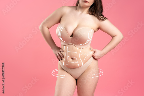 Φωτογραφία Plastic surgery concept, curvy woman body with correction lines, liposuction and