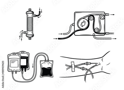 Blood filtration vector process diagram: Apheresis machine filters, separates, and collects blood components from arm