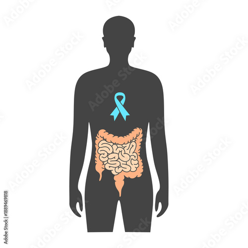 Illustration of the concept of colorectal cancer day, world cancer day, colon cancer. Vector illustration for medical design, template, poster, and education.