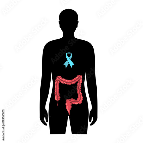 colorectal cancer day illustrstion, world cancer day, The concept of problems in digestion, digestive system, colon cancer. Vector illustration for medical design, template, poster, and education.