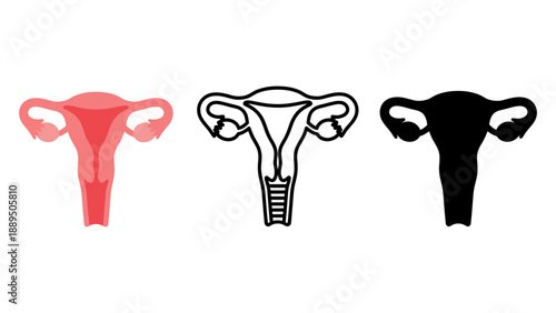 Anatomical illustrations of the female reproductive system including the uterus and ovaries