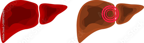 Liver. Health and pain. Paper cut design element. Medical vector layered illustration.