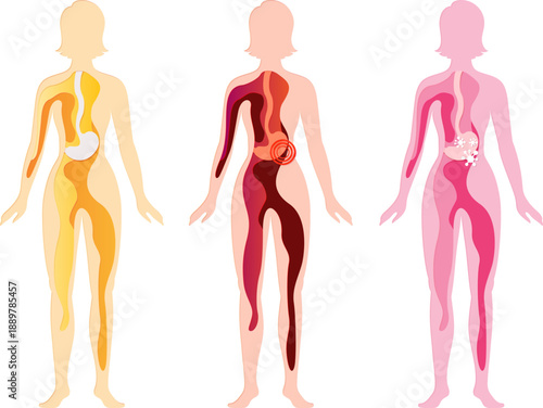 Women silhouette with stomach. Health, pain and illness. Paper cut design element. Medical vector layered illustration.