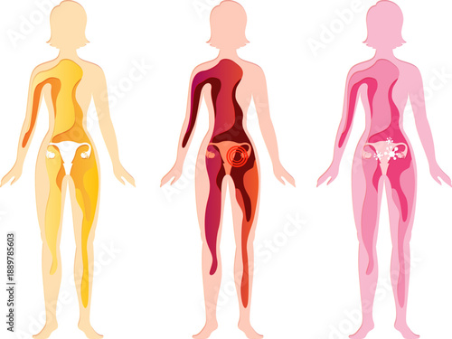 Women silhouette with uterus. Health, pain and illness. Paper cut design element. Medical vector layered illustration.