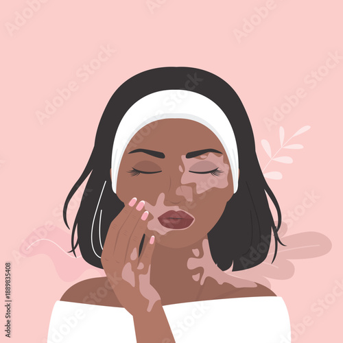 Portrait of an young woman with vitiligo. Avatar of young girl with pigmentation on skin. African american female character with Vitiligo skin problems