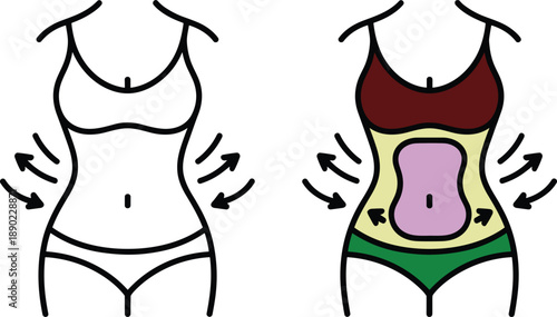 Female body shape comparison illustration showing waist slimming abdomen contouring fitness diet concept vector flat infographic health wellness transformation guide