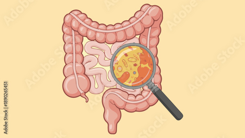 Human Intestines with Bacteria and Magnifying Glass, Gut Microbiome Vector Illustration. Digestive System Microflora Concept, Intestinal Bacteria and Germs with Magnifier Vector