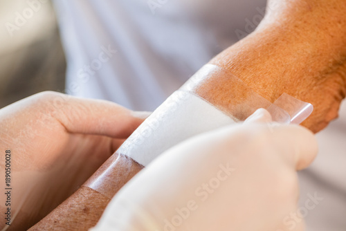 Konstfotografi A close up of nurses hands with gloves applying a hydrocolloid bandage onto an e