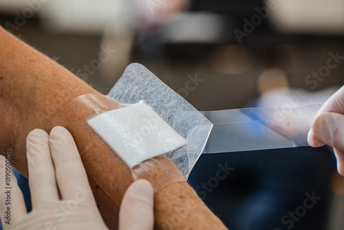 Εκτύπωση καμβά A close up of nurses hands with gloves applying a hydrocolloid bandage onto an e