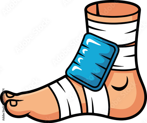 A cartoon illustration of a wrapped ankle with an ice pack on it