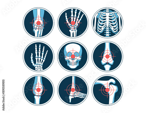 An illustration of various human skeletal system parts with highlighted pain points