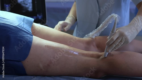 Ultrasound examination of leg veins 4k video. Leg ultrasound for vein check by vascular surgeon.