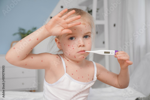 Little girl ill with chicke...